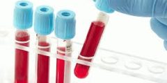تحليل FNS – أهم تحليل للدم تعرف على رموزه وقيمه الطبيعية